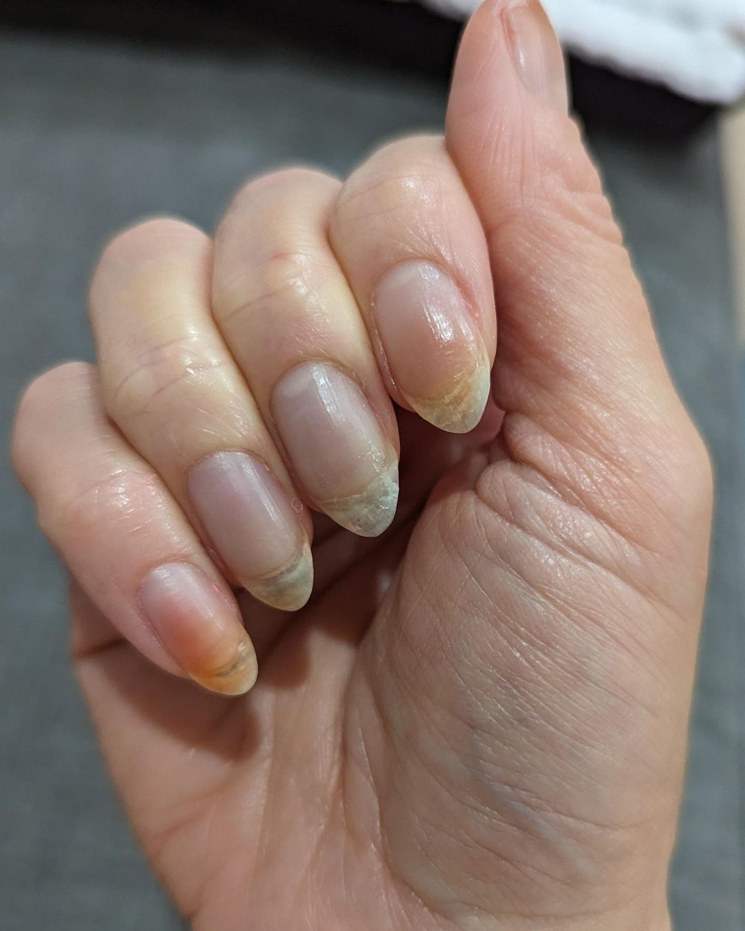 Stunning Almond Nail Ideas You’ll Want to Copy ASAP