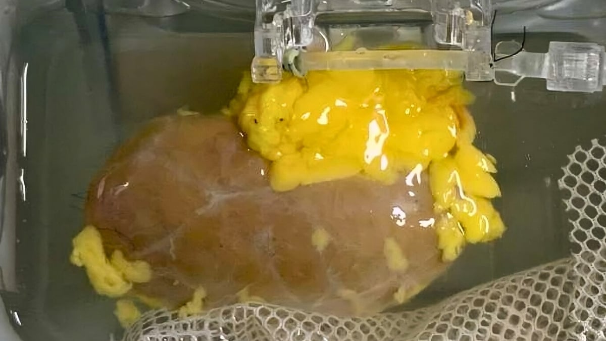 any blood type organ