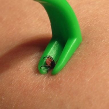 O’Tom Tick Twister Tick Removal Tool